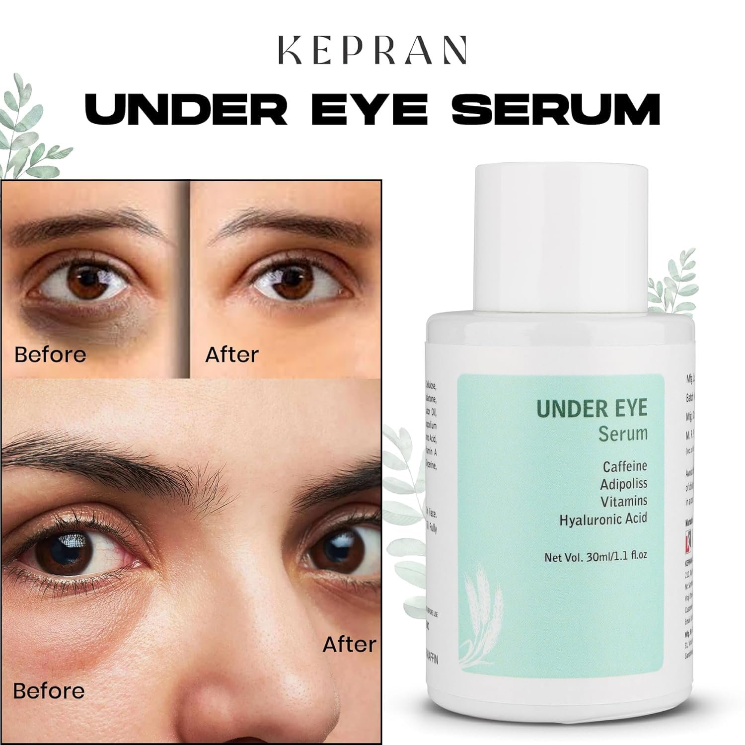 Under Eye Serum with Caffeine, Vitamins, Hyaluronic Acid, 30ml